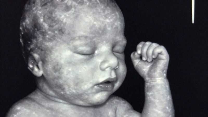 Jak wyglądają twarz i kończyny płodu w 12. tygodniu?