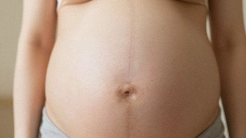 Dlaczego powstaje ciemna linia na brzuchu?