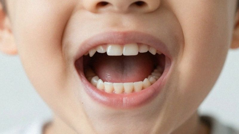 Jakie są negatywne skutki długotrwałego używania smoczka?