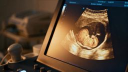 Pierwsze badanie prenatalne — dopochwowo czy przez brzuch? Zalety i wady